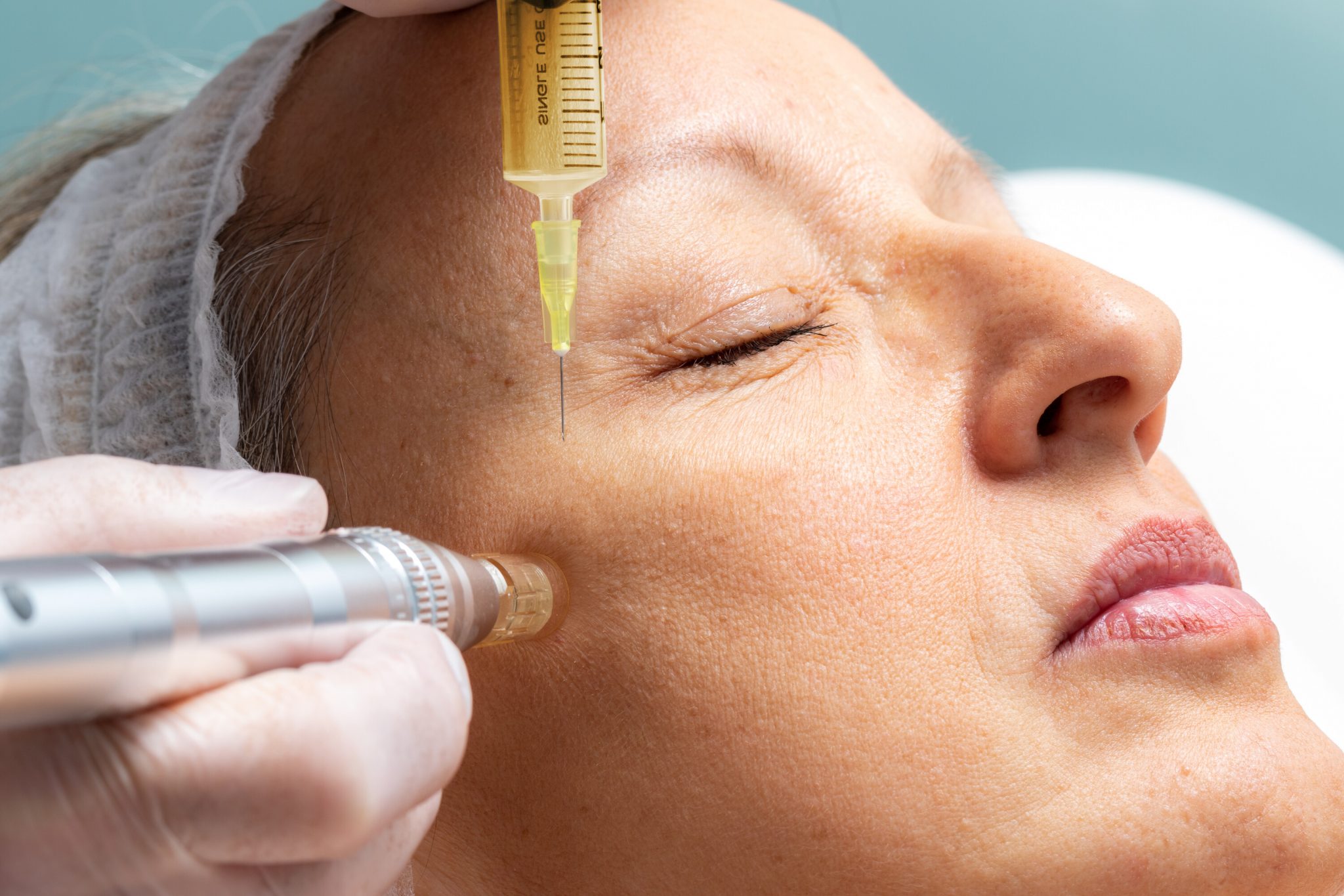 SkinPen Microneedling Therapy In La Costa CA Contact Us Today